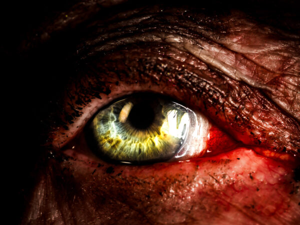 Bilde av et øye